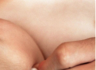 手臂患有白癜風的四個月寶寶如何治療？