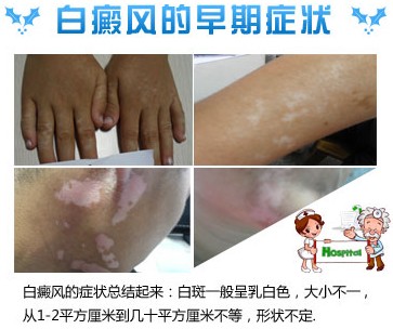 孩子生下鼻子周圍白斑怎么辦