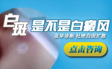 臉上有大塊白斑是不是白癜風早期