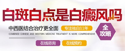小白點是不是白癜風