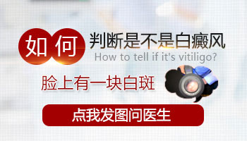 脖子上有一處白斑塊是不是白癜風