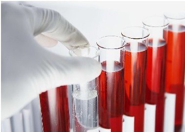 白癜風患者應做哪些血液檢查