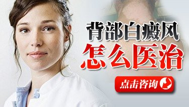 局限型白癜風就是不會擴散嗎