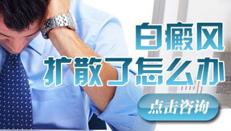 頸部白癜風會擴散到臉部怎么辦