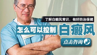 白癜風變大變多該怎么控制