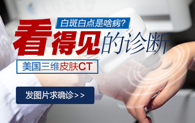 肉眼能分辨身上的白斑是不是白癜風(fēng)嗎