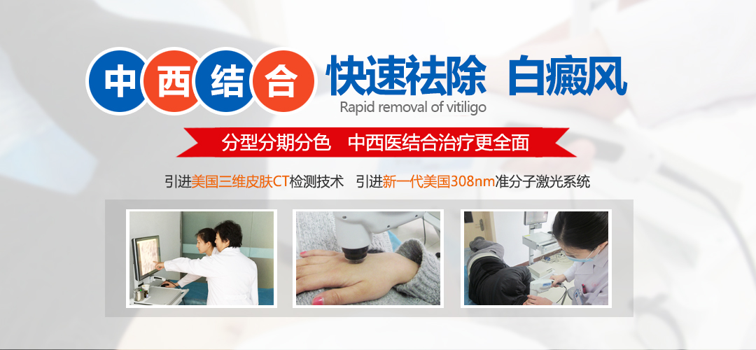 得白癜風一輩子不擴散的多不多