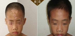 承德白癜風醫院可以確診白斑是否是白癜風嗎