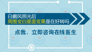 兒童白癜風.jpg