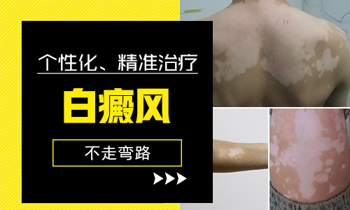 三個月寶寶臉上有小白點白斑怎么回事