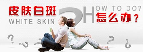 早期白癜風治療優勢你知道嗎