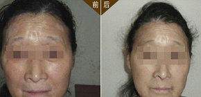 衡水有治療白癜風的好醫院嗎