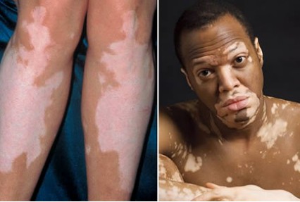 廊坊有可以做皮膚CT的醫(yī)院嗎