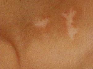 <a href=http://www.xvxgx.cn/ target=_blank class=infotextkey>石家莊白癜風醫院</a>醫師威解析怎么辨別<a href=http://www.xvxgx.cn/zhengzhuang/4732.html target=_blank class=infotextkey>白癜風早期癥狀</a>