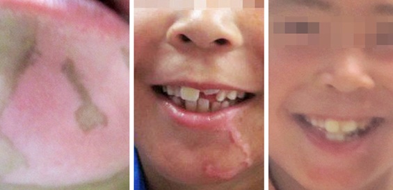 “健康六一，快樂祛白”大型兒童祛白診療援助活動啟動