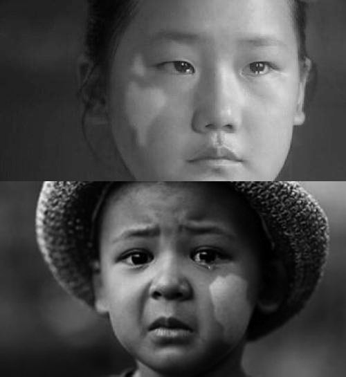 迎六一*兒童白癜風(fēng)惠民普查公益活動開啟