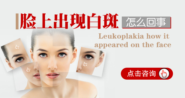女面部白癜風怎樣治療