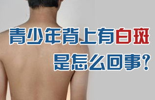 引發(fā)青少年白癜風(fēng)的原因