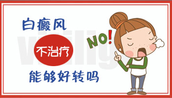 長白斑不治療會擴散嗎