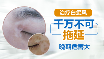 臉上有白癜風(fēng)影響高考體檢嗎