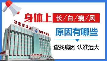 高中生為什么患上白癜風的幾率越來越大