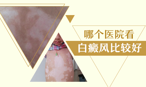 石家莊三甲醫院有治療白癜風好的醫院嗎