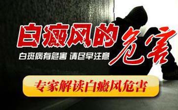 腳部白癜風不治療會不會擴散