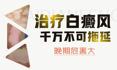 中年女得白癜風不治療會有什么嚴重后果