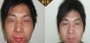 白癜風總不好是啥原因邢臺能治嗎