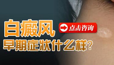 邢臺兒童白癜風早期癥狀有哪些