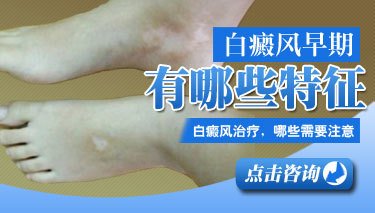 邢臺白癜風醫(yī)院治療臉部出現(xiàn)的白癜風效果如何