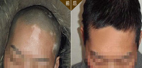 這么的療法，我相信你沒用過