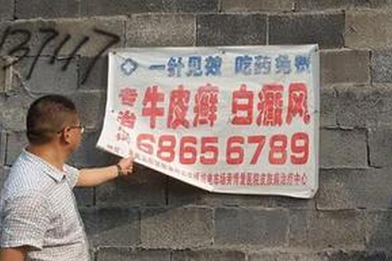 從天而降的“驚喜”真的是治療白癜風的希望嗎