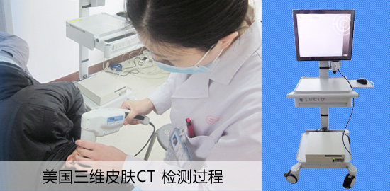 美國三維皮膚CT檢查免費，限時搶