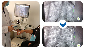 4.15白癜風(fēng)防治日暨白斑免費(fèi)普查活動(dòng)開啟