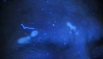 4●15白斑免費普查活動結束 疫情后門診量創新高