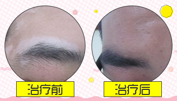 “為愛發聲·十月一起告白”醫師會診活動暨創院十三周年白癜風治療成果展