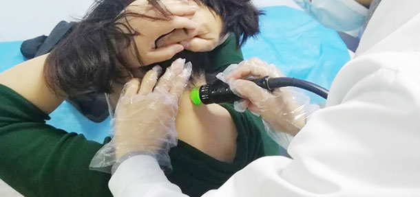 脾多肽注射液聯合308nm準分子激光治療白癜風臨床療效評估