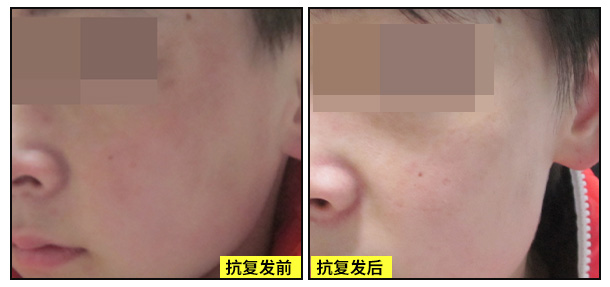 迎五.一勞動特邀京冀白癜風醫(yī)師蒞臨我院開展聯(lián)合會診