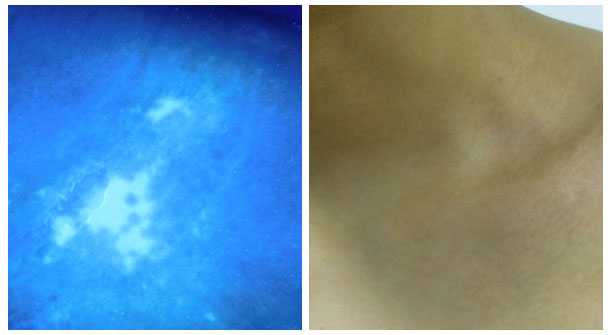 【醫德高尚暖人心,醫術精湛傳四方】白癜風康復患者送來感謝錦旗