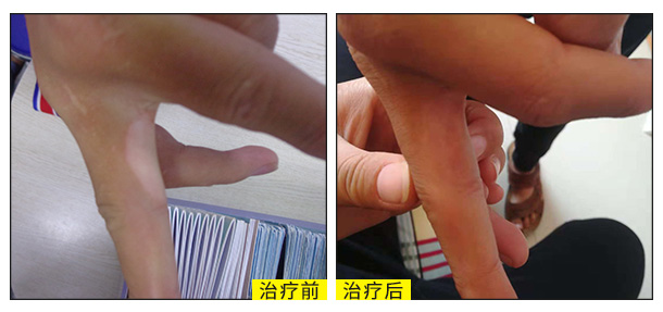 喜迎國慶,金秋送健康北京白癜風醫師大型會診援助活動啟動!