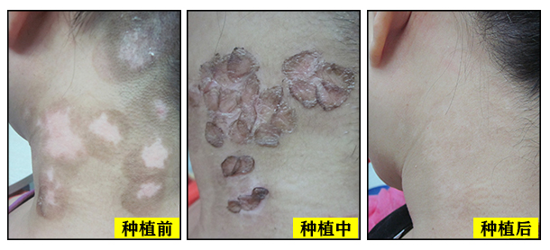 安心就醫·塑造專科典范——經驗醫生聯合坐診讓你安心就醫