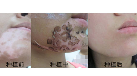 7天喚醒黑色素,寒假不留白 體面迎新年!