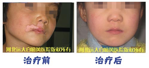 嘴唇表皮里有白點(diǎn)是怎么回事?