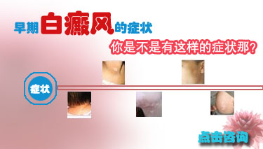 胳臂上起得白斑可能是白癜風