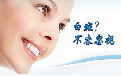左臉長了一大片白斑會是白癜風嗎
