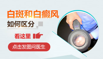 寶寶額頭上有一小塊白好幾年了是怎么回事