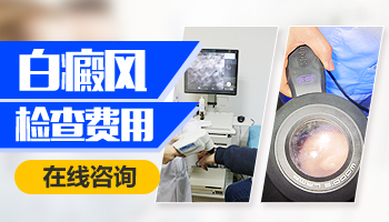 做所有的白癜風(fēng)檢查項(xiàng)目多少錢(qián)