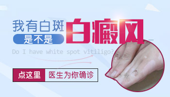 眼角邊上有白點是白癜風嗎