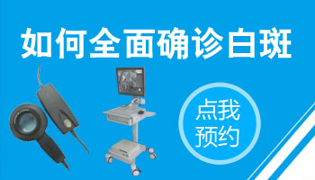 頭上有塊白斑是不是白癜風